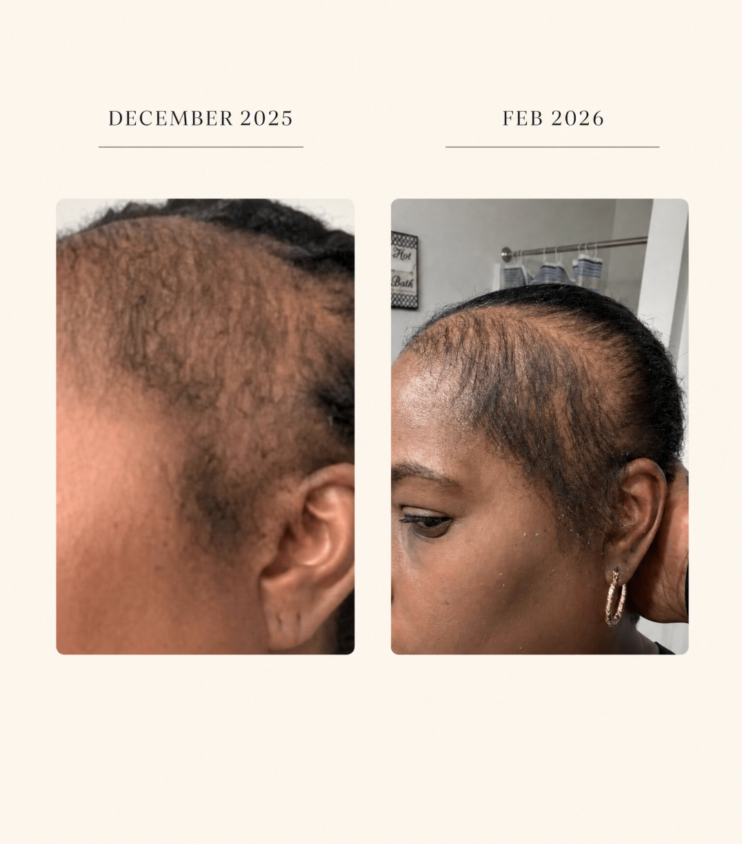 Ruach Hair Oil Triple Deluxe Pack | A Follicle Stimulating Formula