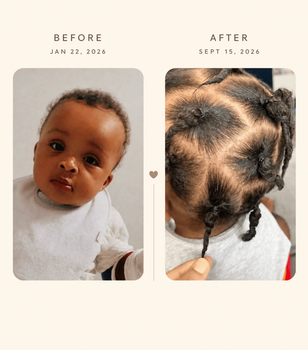 Ruach Hair Oil 8oz Deluxe | A Follicle Stimulating Formula