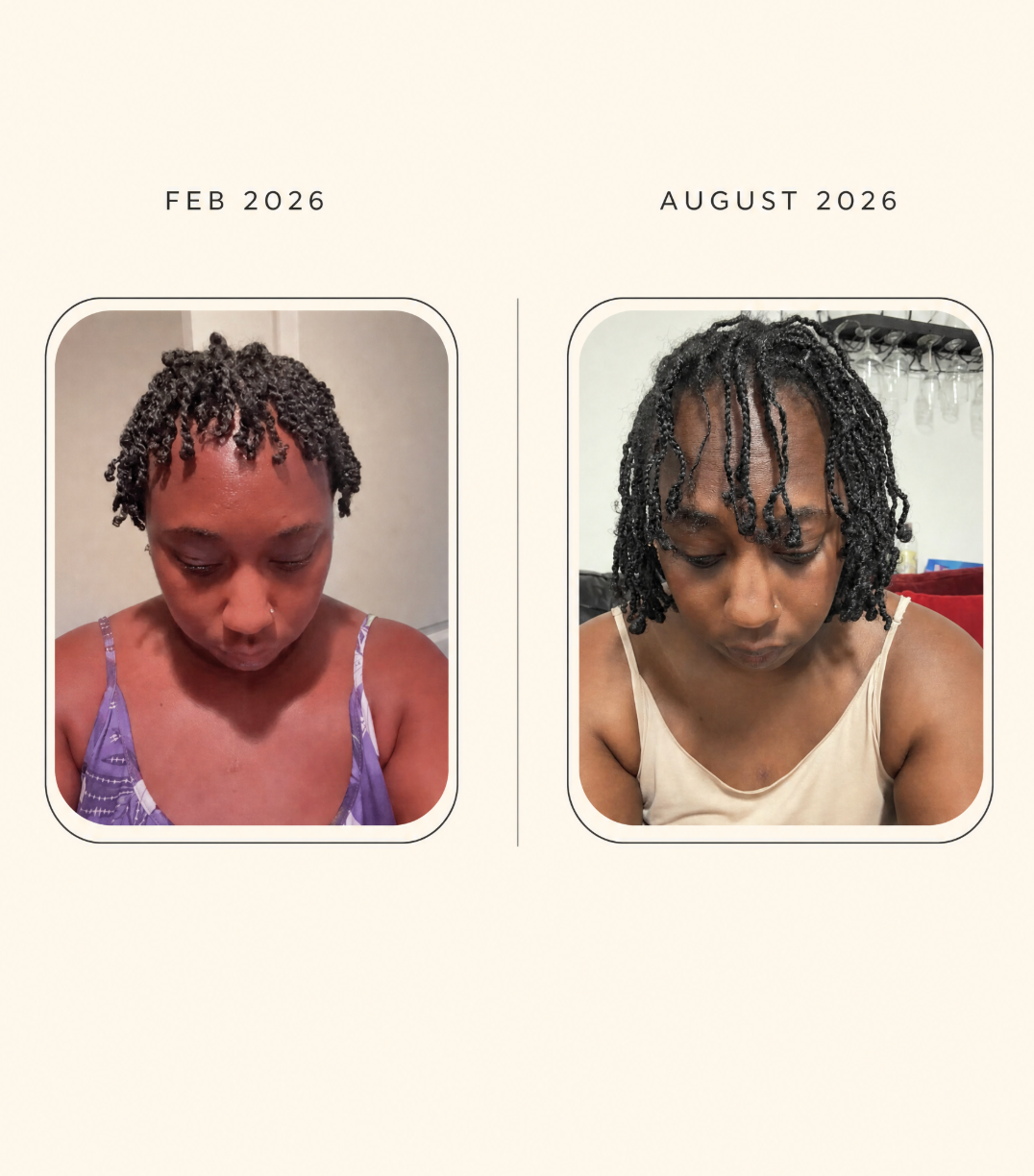 Ruach Hair Oil Travel Sizes | A Follicle Stimulating Formula
